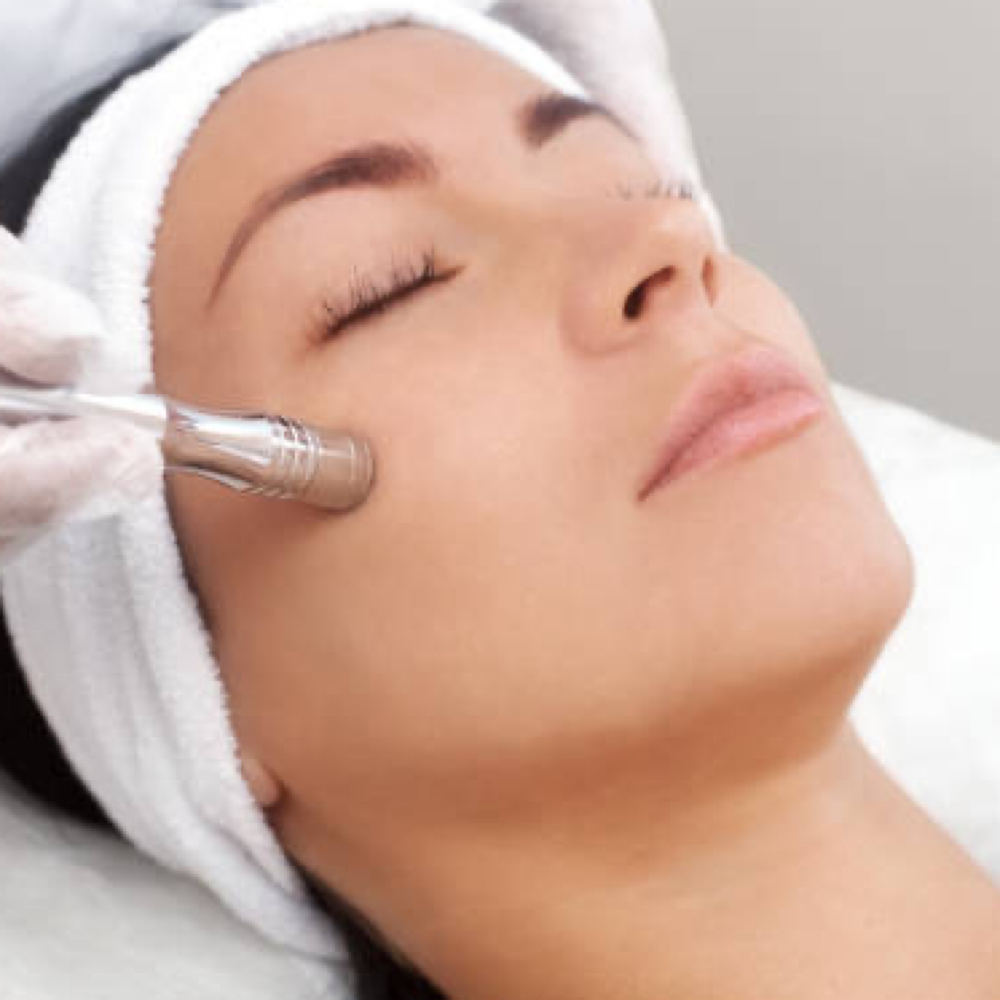 Diamond Microdermabrasion at Dermalove Aesthetics in Portland, OR