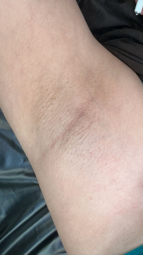 Under Arm Wax
