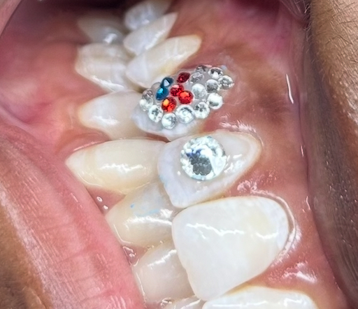 Tooth Gem at Classy Kelsey in San Antonio, TX