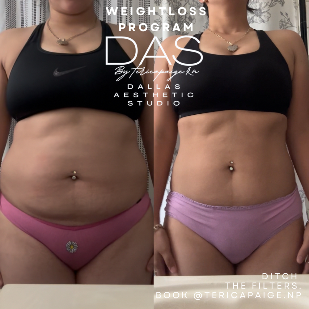 Weightloss Program Virtual Consult at Dallas Aesthetic Studio in Dallas, TX