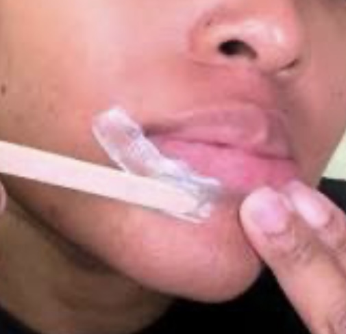 Lower Lip Wax