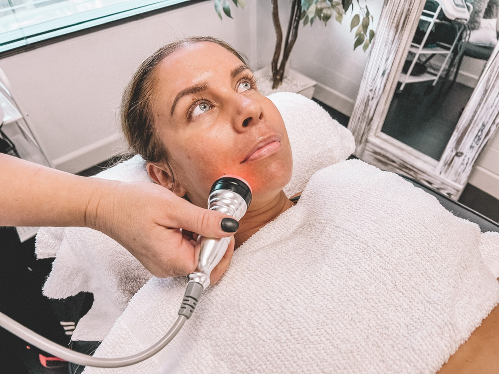 Radio Frequency Facial