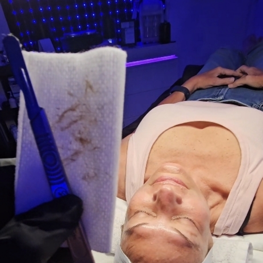 The Got to Glo Dermaplane Facial at LexGlo Esthetics in Idaho Falls, ID