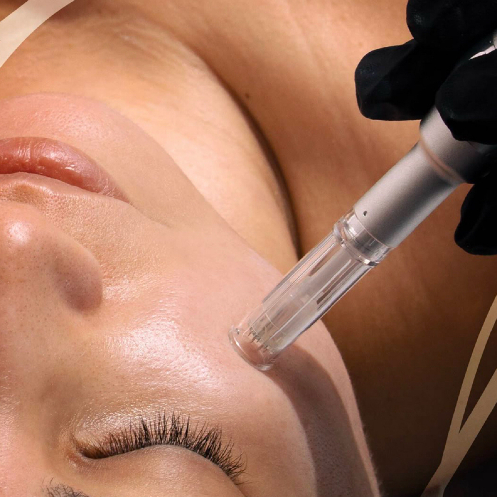 Microneedling Package Of 3 Stemcell