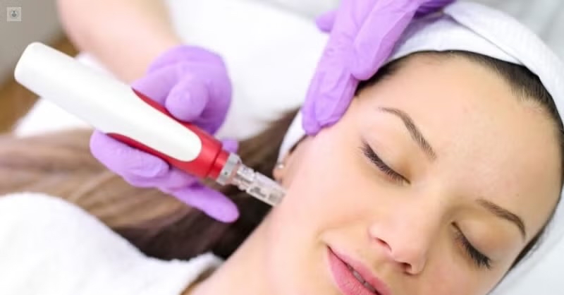 Dermapen (microagujas)