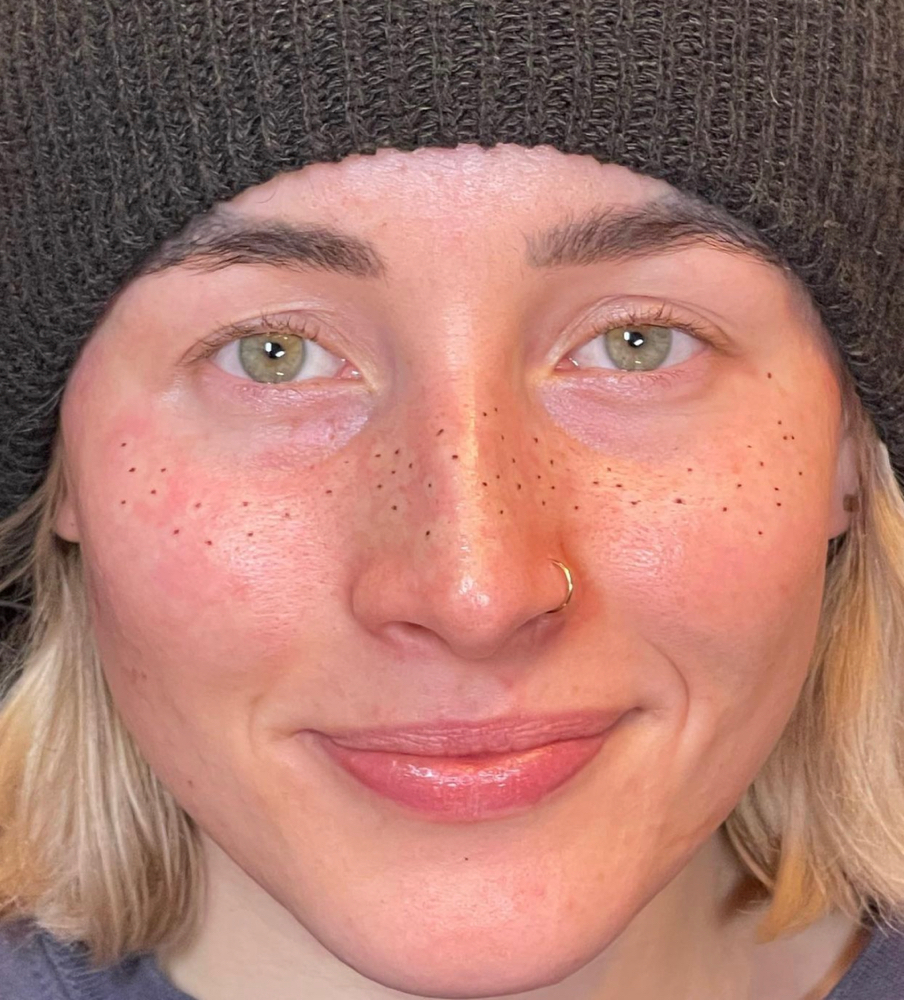 Freckles at Mjartistry in Manahawkin, NJ