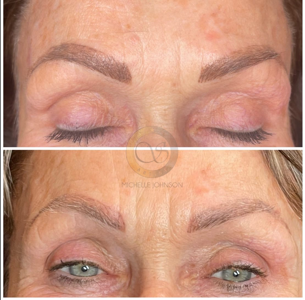 Saline Removal at Mjartistry in Manahawkin, NJ