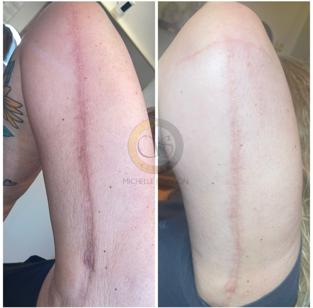 Scar Camouflage at Mjartistry in Manahawkin, NJ