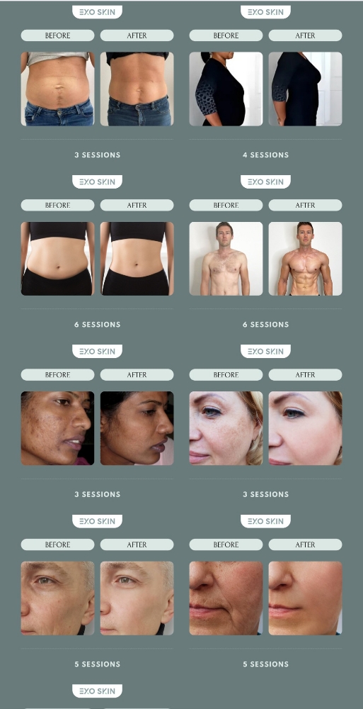 ExoSkin Body & Facial Packages