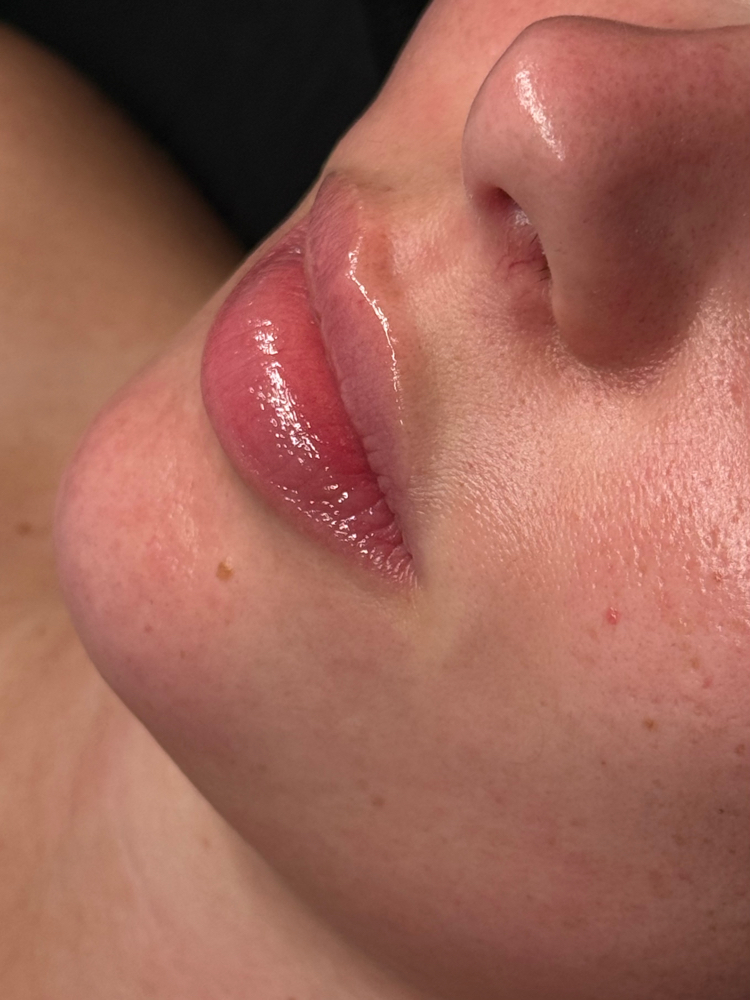 the custom facial at Butler Skin in Sheridan, WY