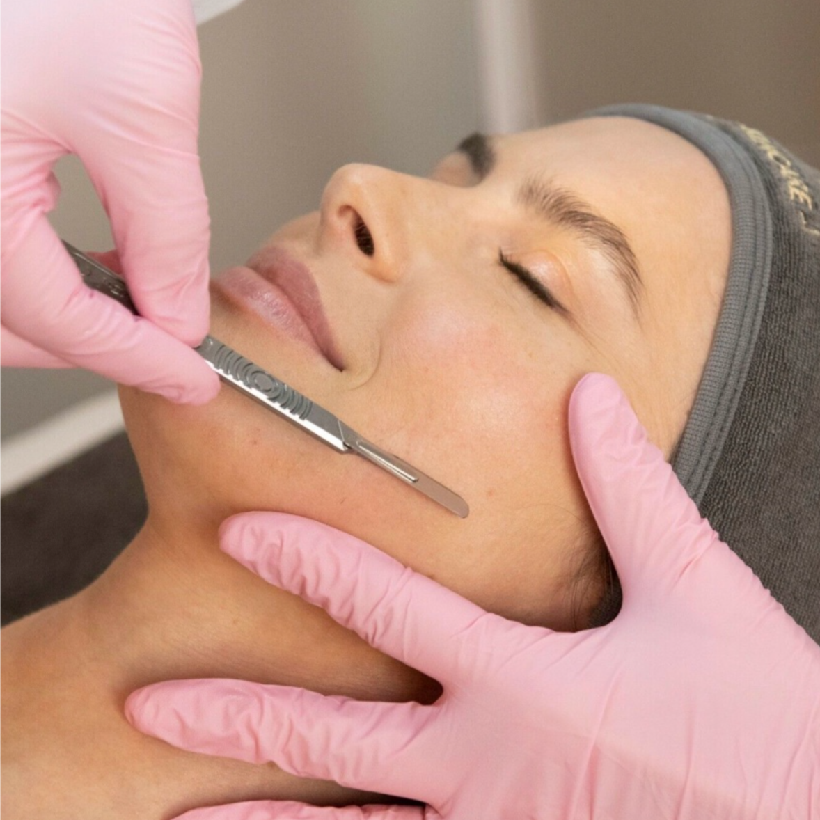 SALE Dermaplane Facial