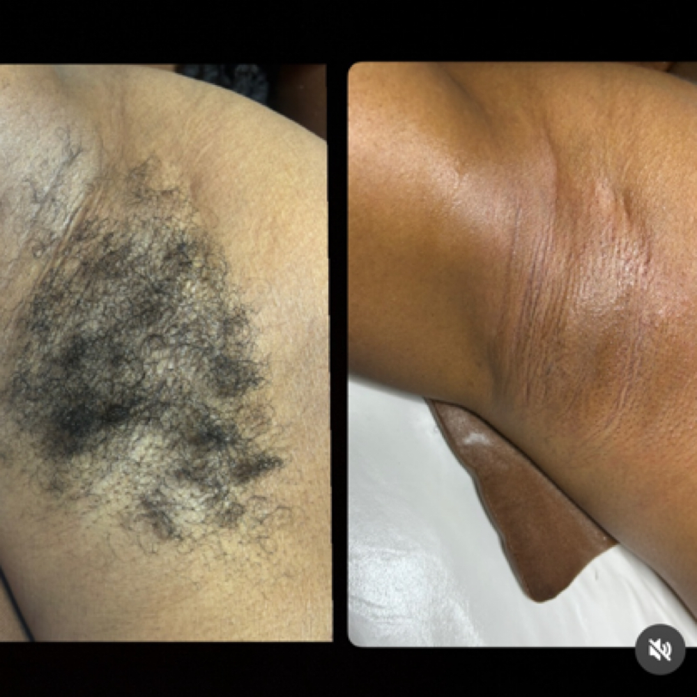 Chula Underarms at Gabriellas self care studio in Mesquite, TX