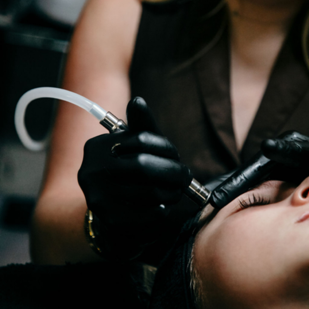 Diamond Dermabrasion at Reese SkinTreat in Cape Girardeau, MO