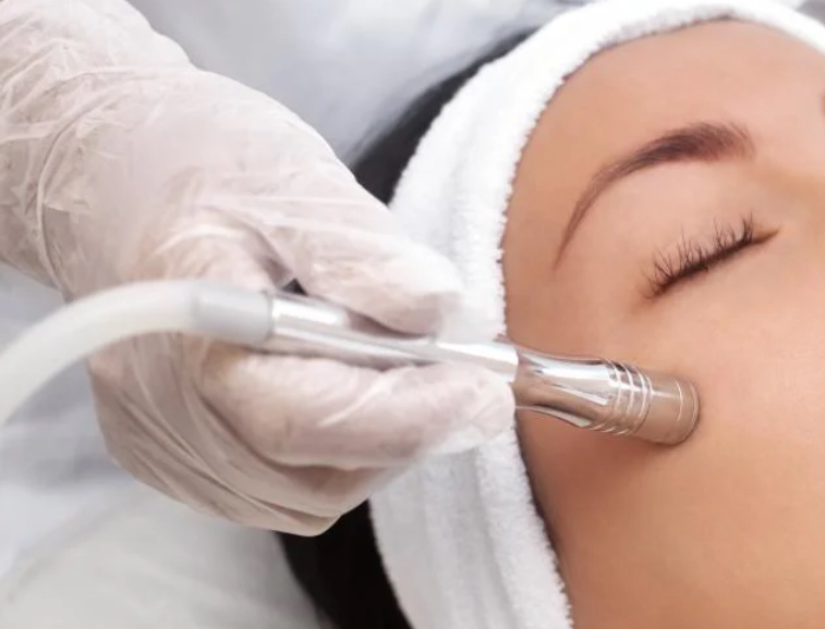 Diamond Dermabrasion