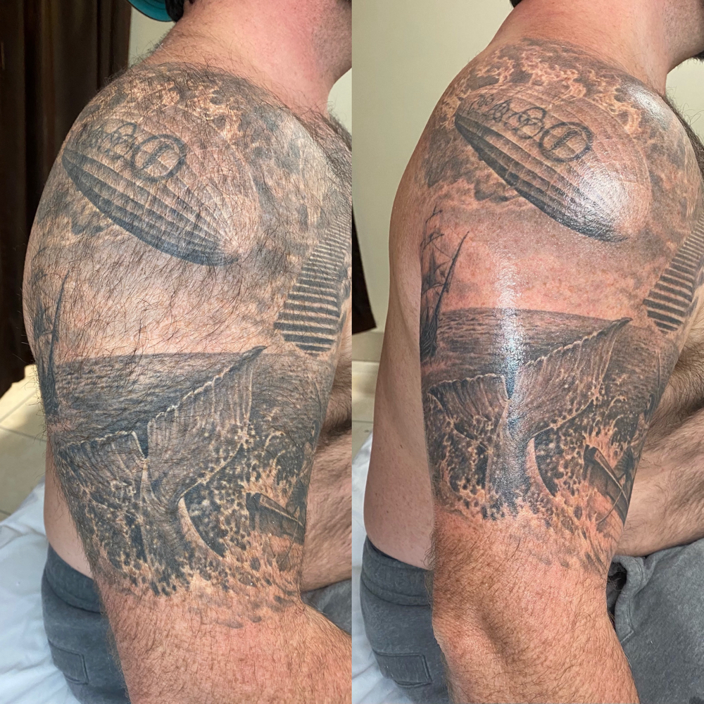 Half Arm Wax
