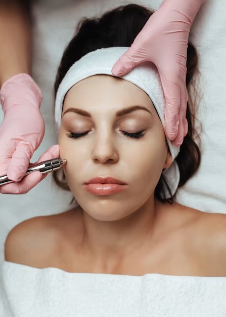 Microdermabrasion Facial