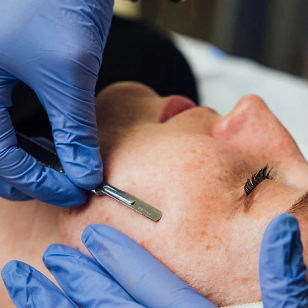 Dermaplaning at Beauty Lounge Prosper in McKinney, TX