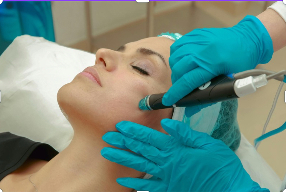 Hydrodermabrasion Facial