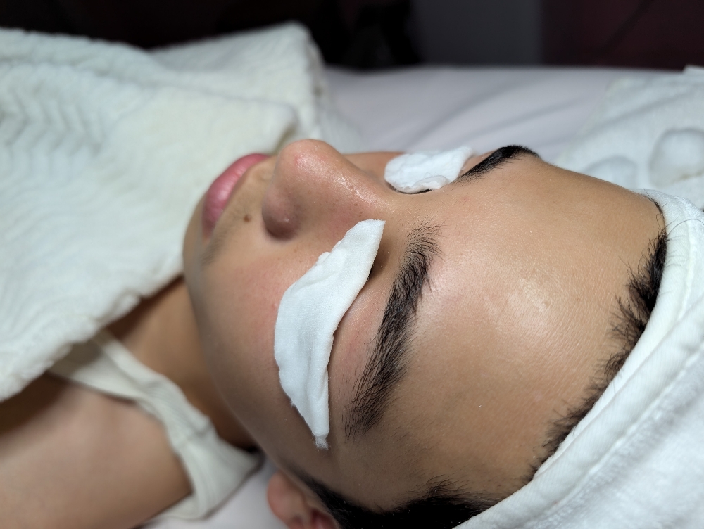 Teen facial