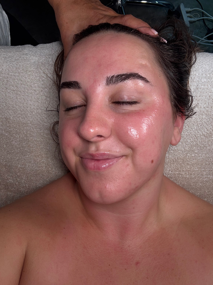 Diamond Microdermabrasion facial