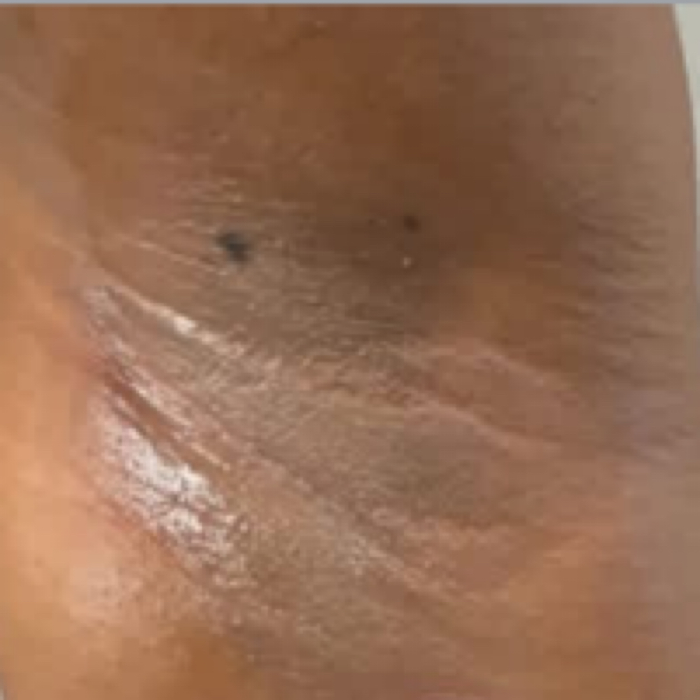 Under Arm at Waxed Skyn in Cincinnati, OH