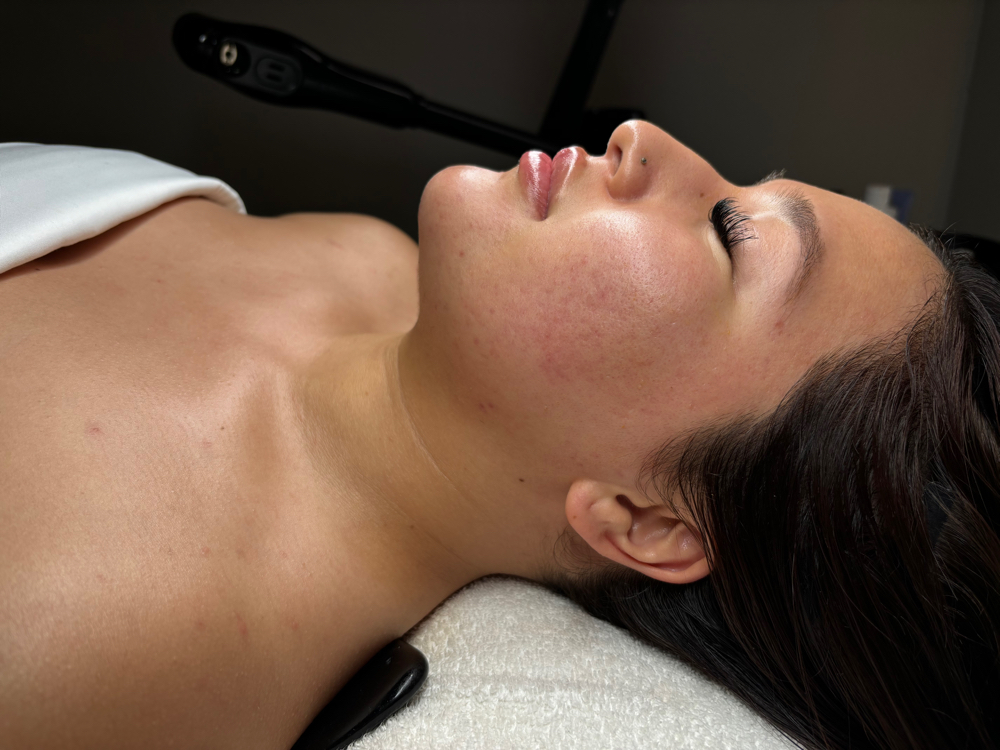 Deep Cleansing Facial