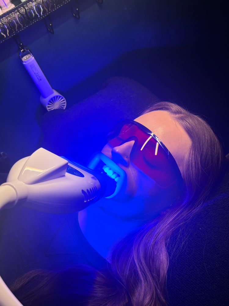 Teeth Whitening