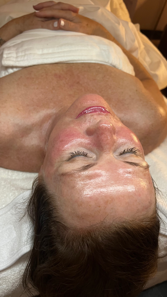 Glass Skin Peel Add-On