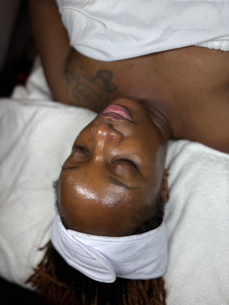 RWB New Client Skin Reset