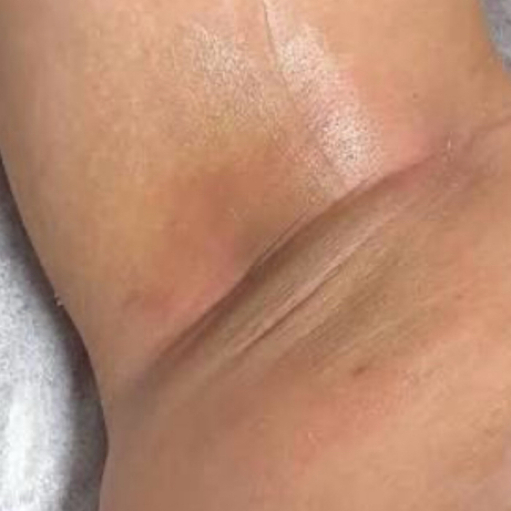 Underarm Wax at Bare Beauty Esthetics in Oklahoma City, OK