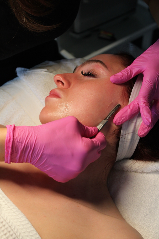 Dermaplane Facial