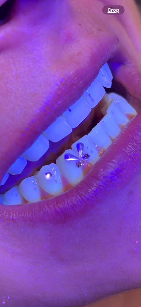 Tooth Gems