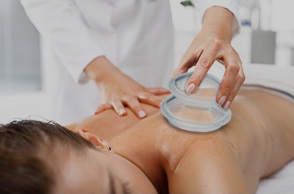 Add-on: Cupping