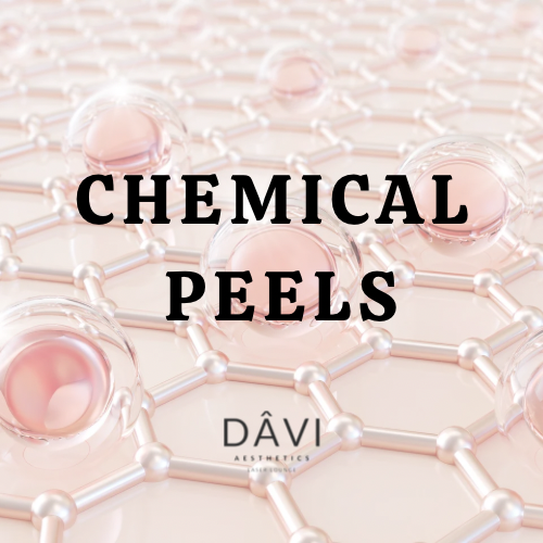 Chemical Peels | Levels