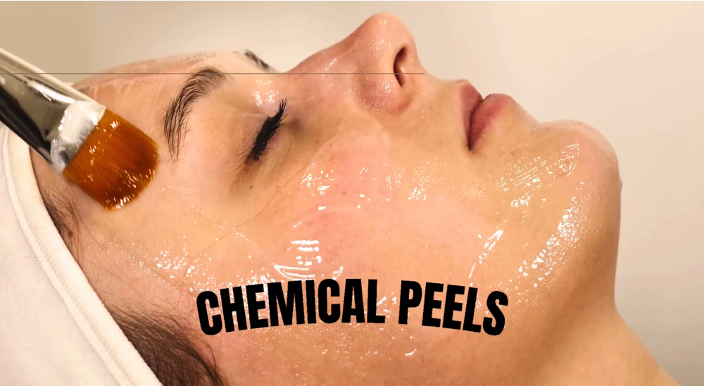 Chemical Peels | All Levels