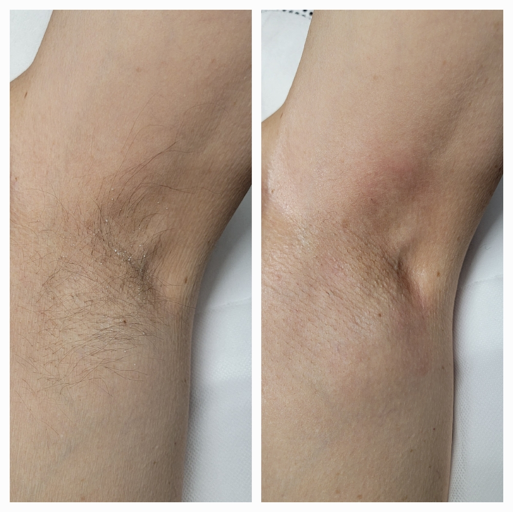 Underarm Wax
