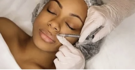 Dermal Filler