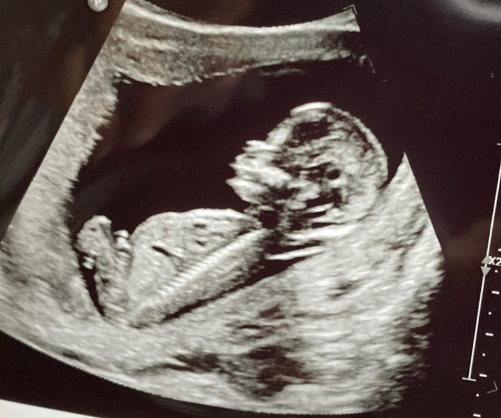 Ultrasound Short Set