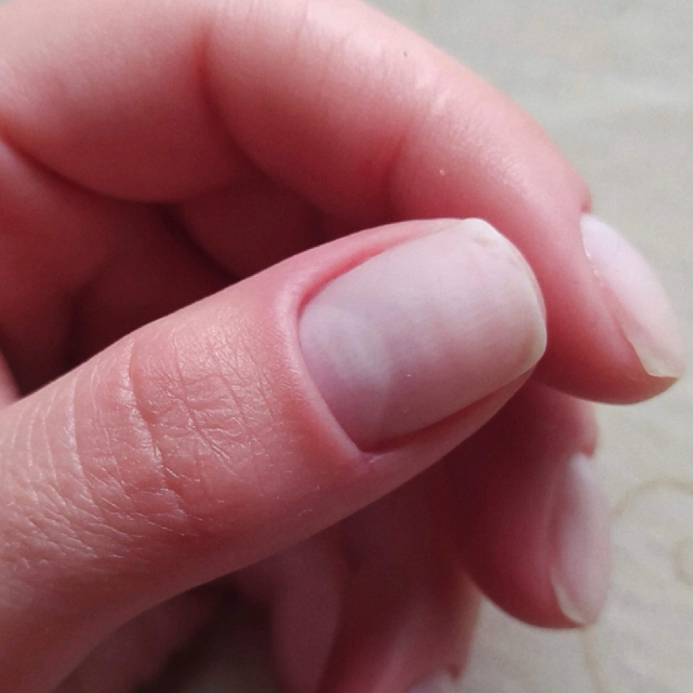 Gel Removal at Intermezzo Nails in Naperville, IL