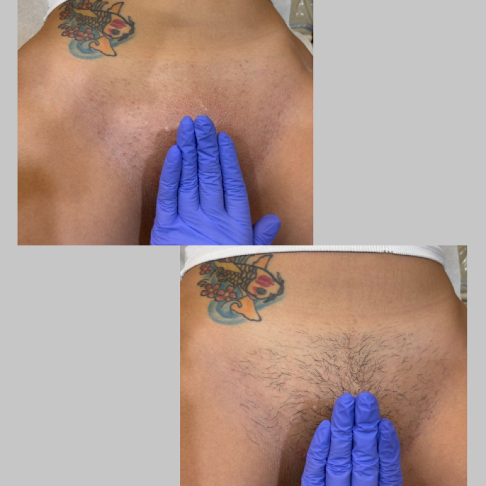 Women’s Full Brazilian at Studio Sunday in Nutley, NJ