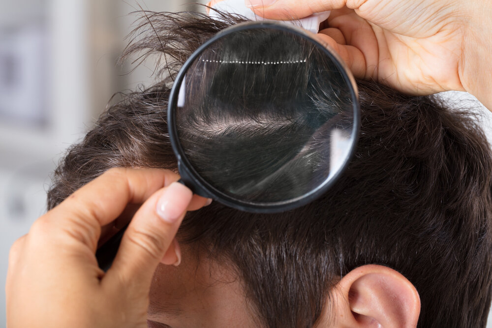 Scalp Treatment