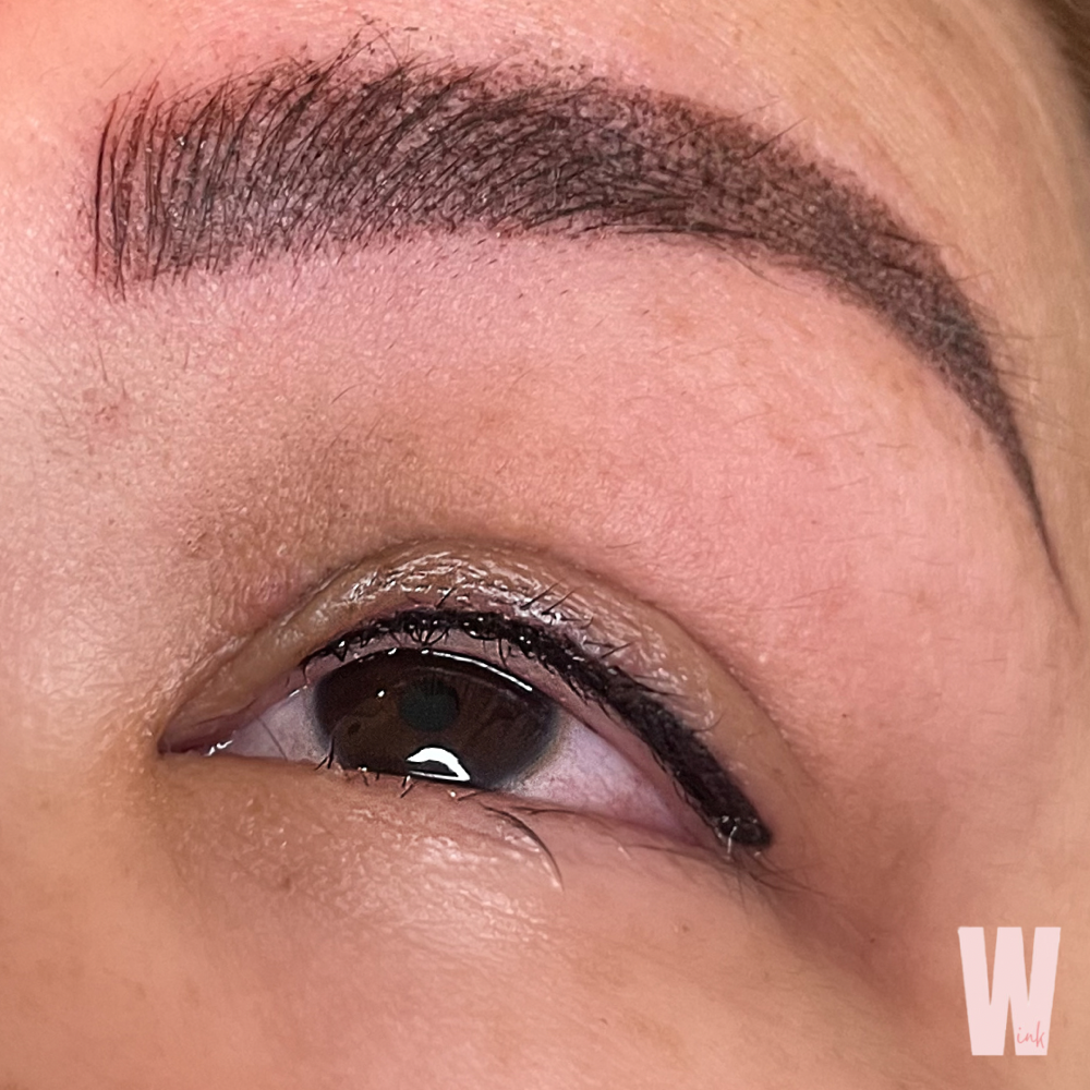 Yearly Liner Followup