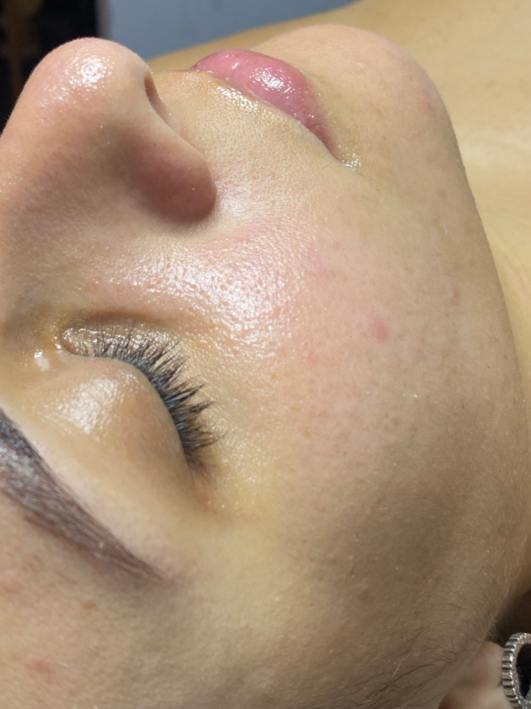 Aura Facial
