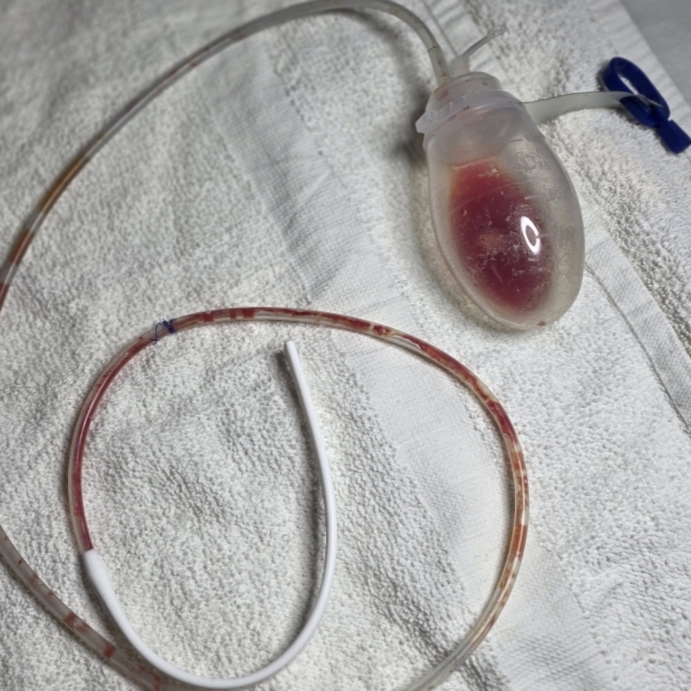 Lymphatic Drainage Massage(6 Sess) at 829 Esthetics in Milwaukee, WI