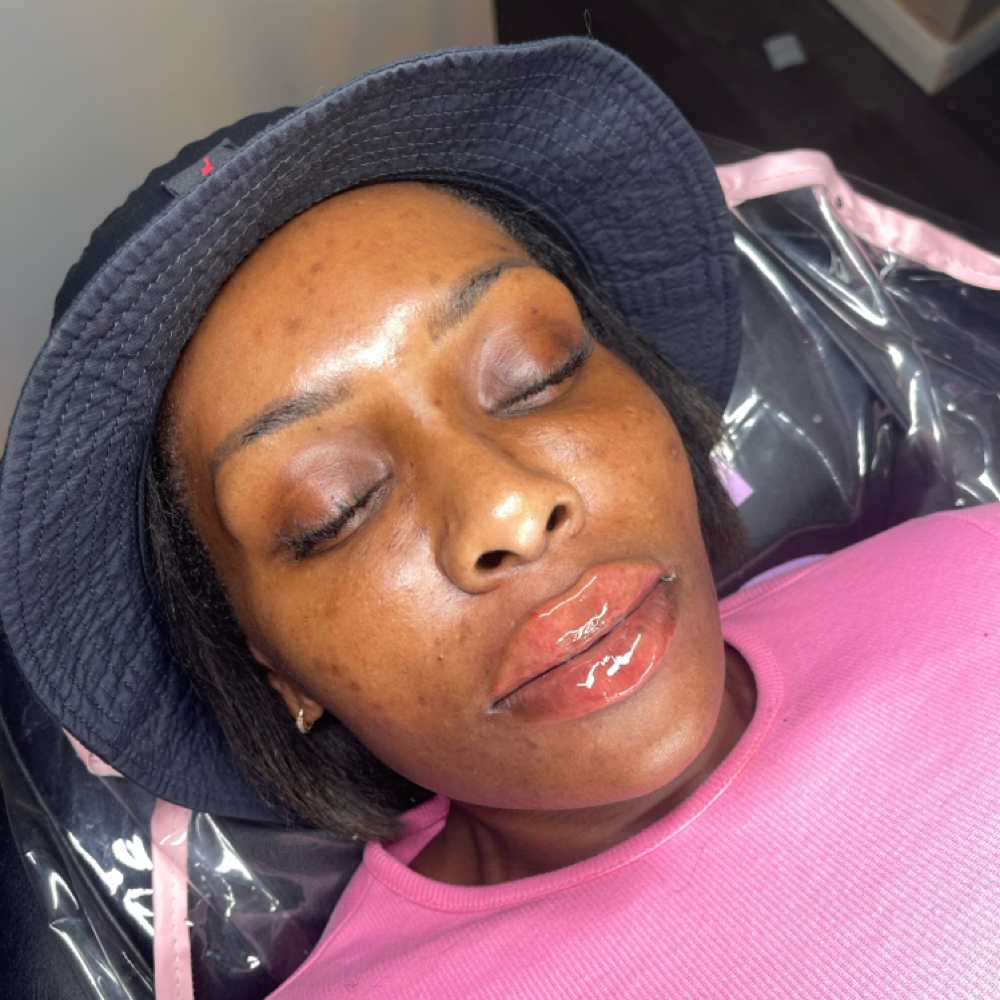Russian Lip 1.5mL at Sevrae Aesthetics in College Park, GA