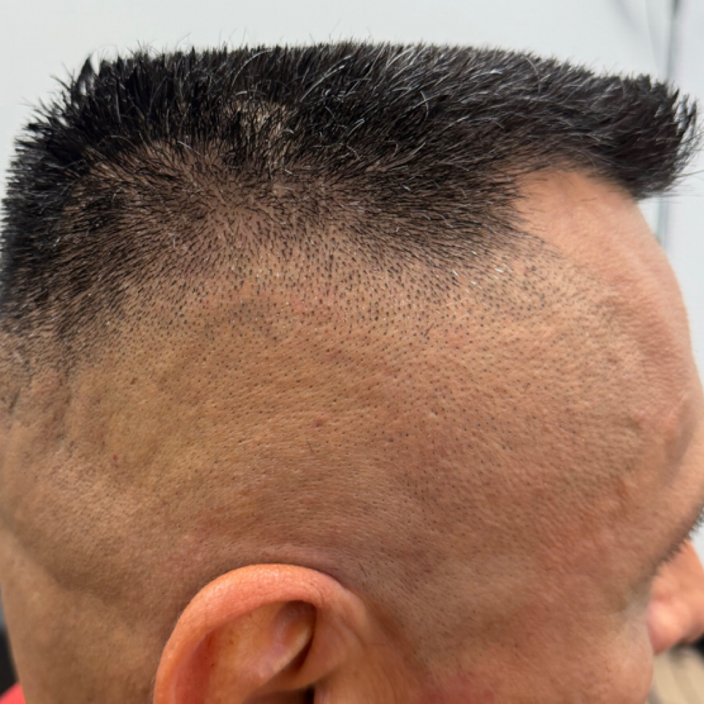Signature Bald Fade at Colby with NCCG in Rock Hill, SC
