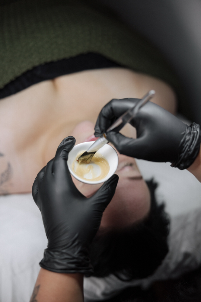 Acne Facial