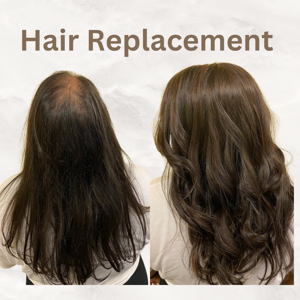 Hair Replacement Consultation