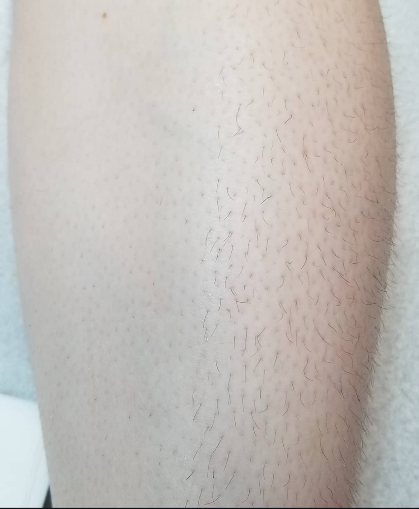 Full leg wax