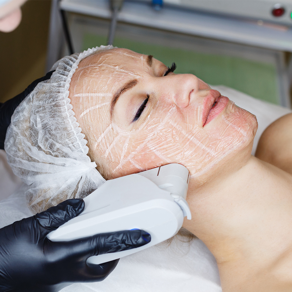Ultherapy